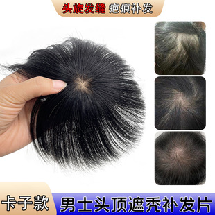 Wig piece men's artificial human hair head spin hair seam men's reissue cover scar head top rare hair loss reissue piece