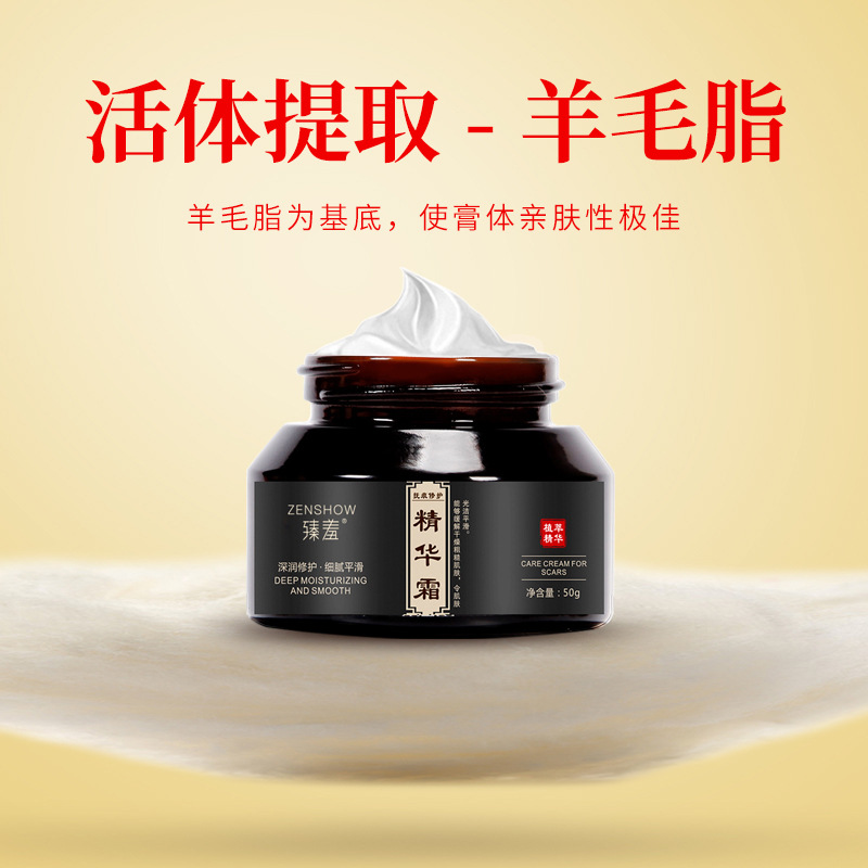 Zhenshi Skin Smoothing Repair Cream, Stretch Mark Repair Cream, Postpartum Repair, Stretch Marks Soothing Cream, Acne Marks Removal Cream