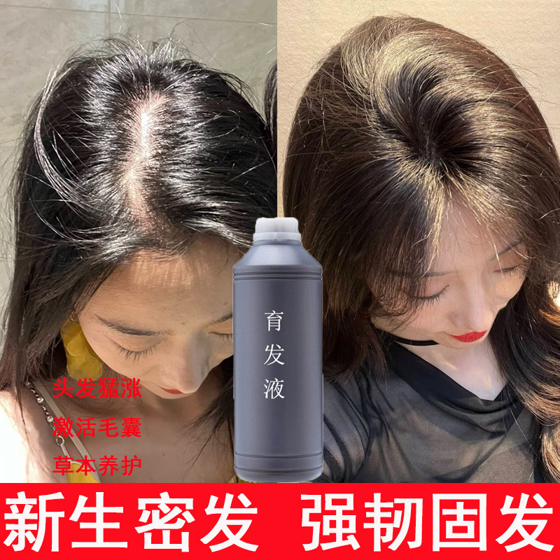 防脱生发液育发液精华液发际线增长头发猛长激活毛囊侧柏叶育发剂|undefined