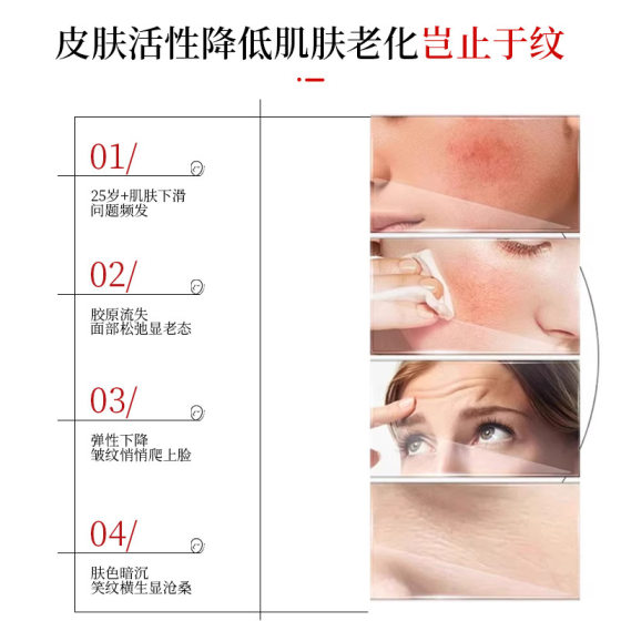 Shake Tone Wei Xuehe Shi Same-style Qin Han Jilian Tong Yan Collagen Cannon Infusion Mask Anti-wrinkle Firming Moisturizing and Skin Rejuvenating