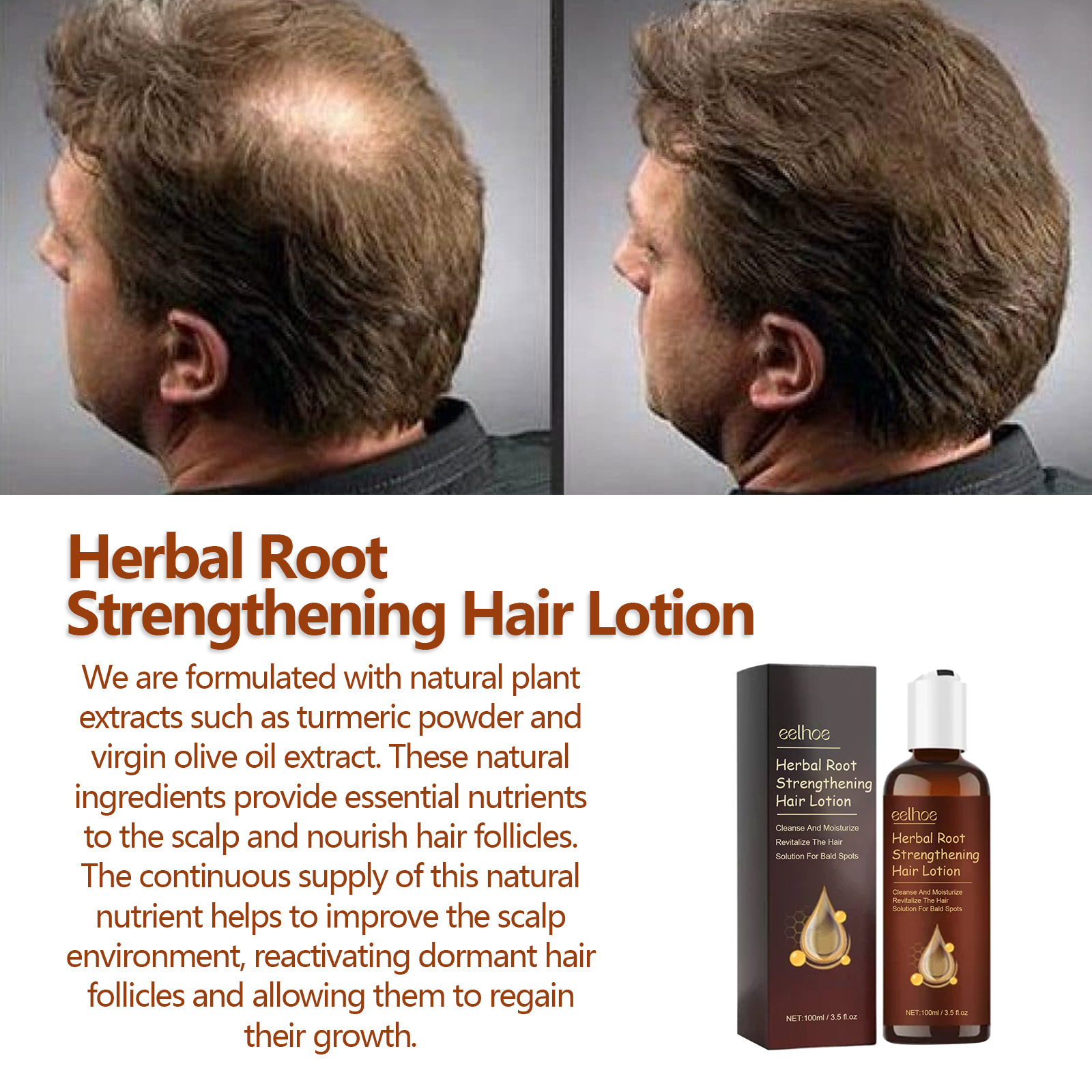 EELHOE zeliščni losjon za lase od korenin učvrsti in obnovi debelo lasno linijo, krepi lase, vlaži lase in preprečuje izpadanje las_voghion.com