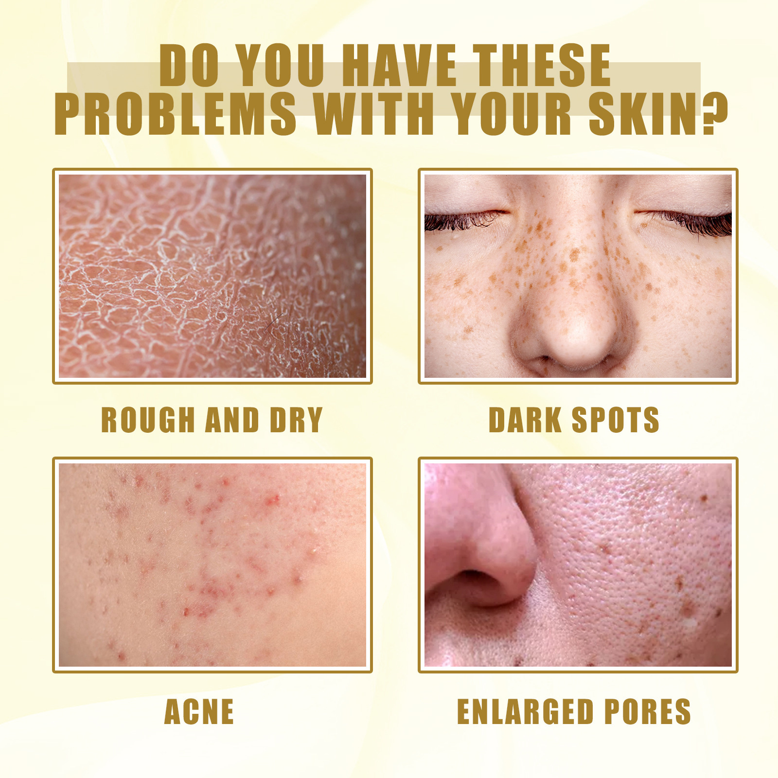 EELHOE-Öl zur Tiefenreinigung, zum Peeling abgestorbener Haut, zum Verblassen von Flecken, zur Befeuchtung, Aufhellung und Verschönerung_voghion.com