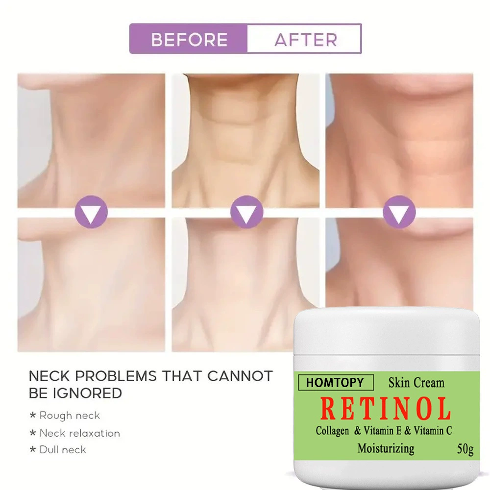 Новый трансграничный осветляющий и украшающий крем для лица, который уменьшает хлоазму лица, солнечные пятна и пятна, осветляет и омолаживает косметический крем для кожи.