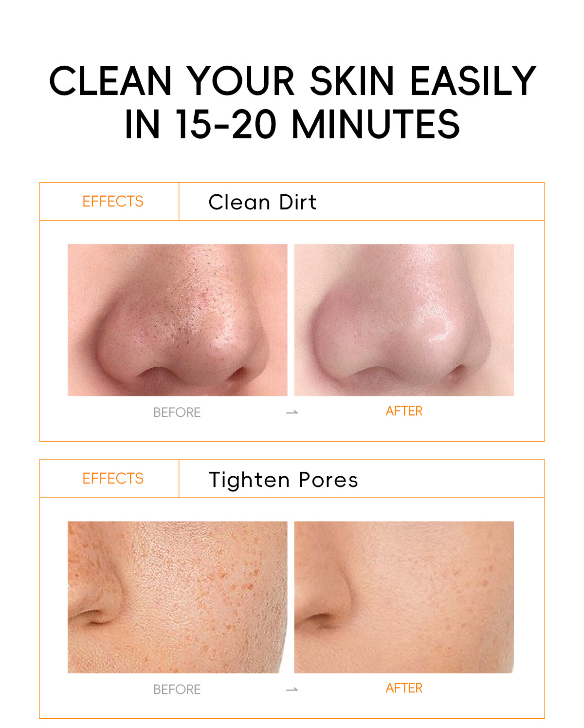 Cross-border LAIKOU Vitamin c peel-off Mask 50g(Tube) for pore cleansing, fda cosmetics manufacturer, in English stock undefined