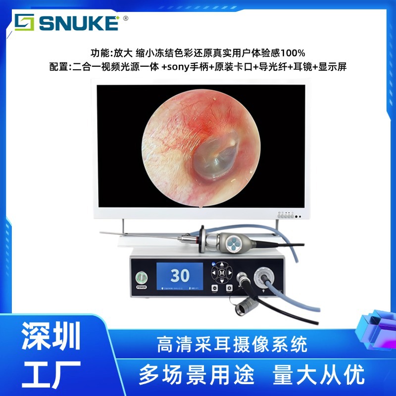 Shinuoqi HD Imaging Visual Ear Picking Instruments and Equipment Ear…