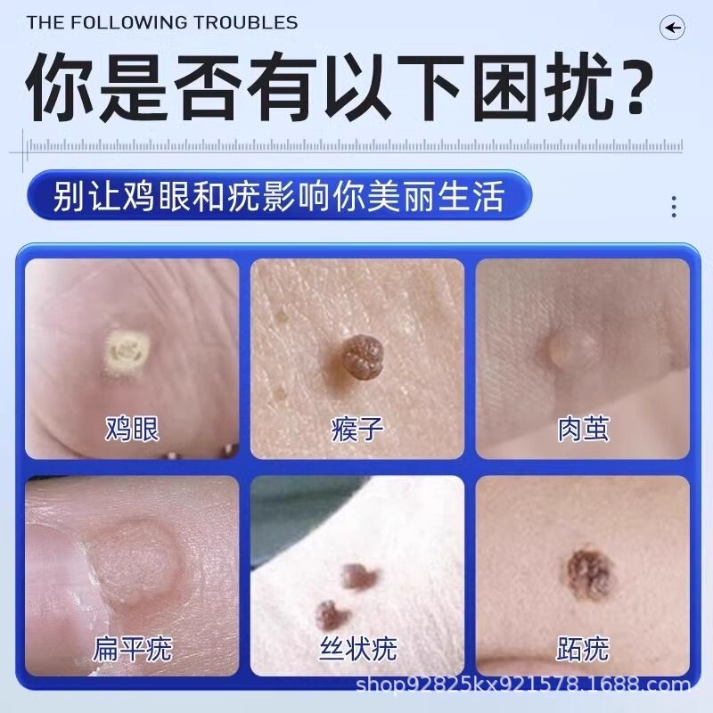海氏海诺鸡眼贴老茧脚茧鸡眼膏足部护理鸡眼护理盒修护|undefined