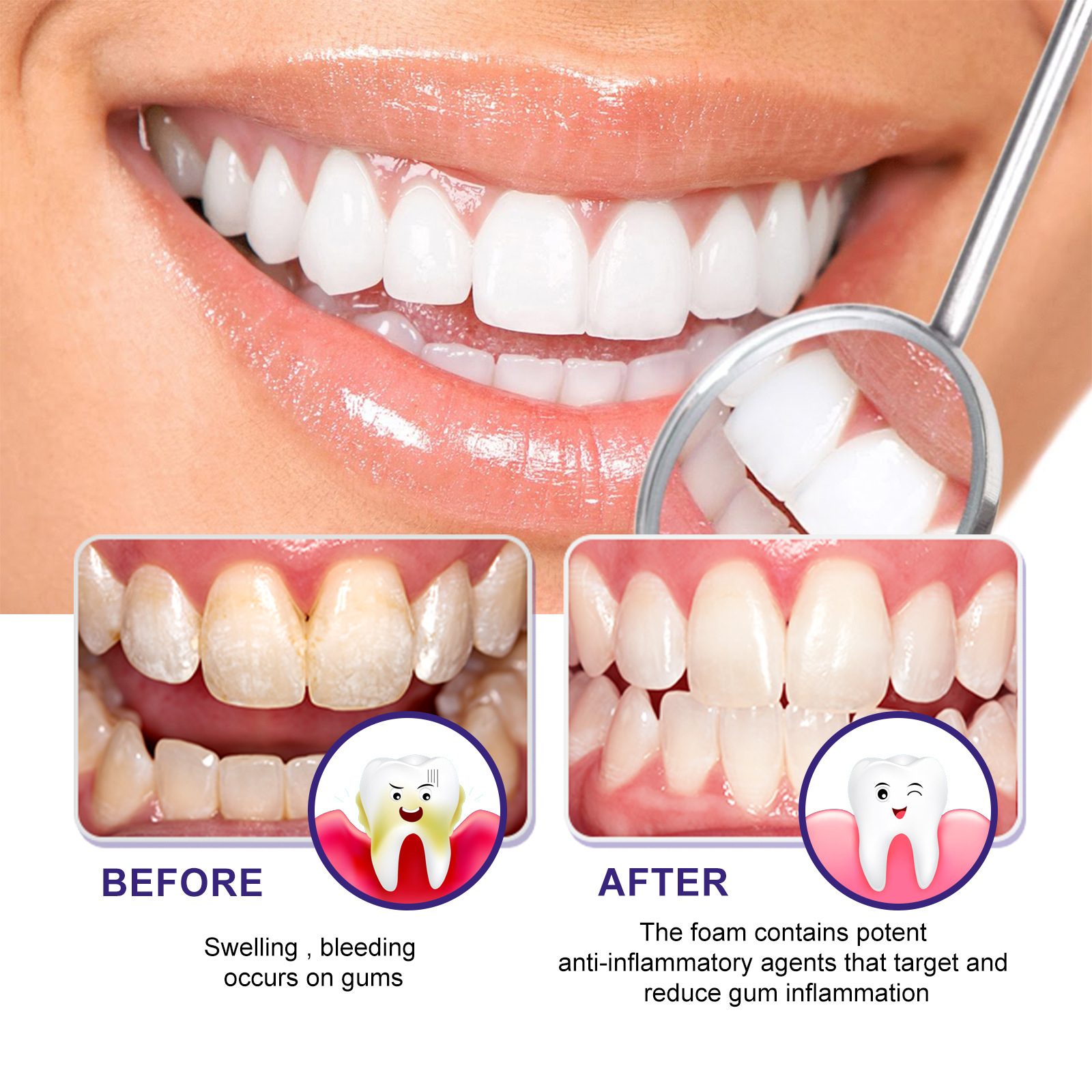 West&Month Schiuma di gomma Mousse Pulizia delle macchie dei denti Cura dello sporco Dentifricio sbiancante orale_voghion.com