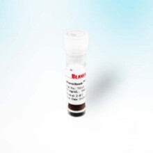 Beaver�����Ͼ����Ȼ�����(3&mu;m)	70127-1	1mL,50mg/mL,3&mu;m