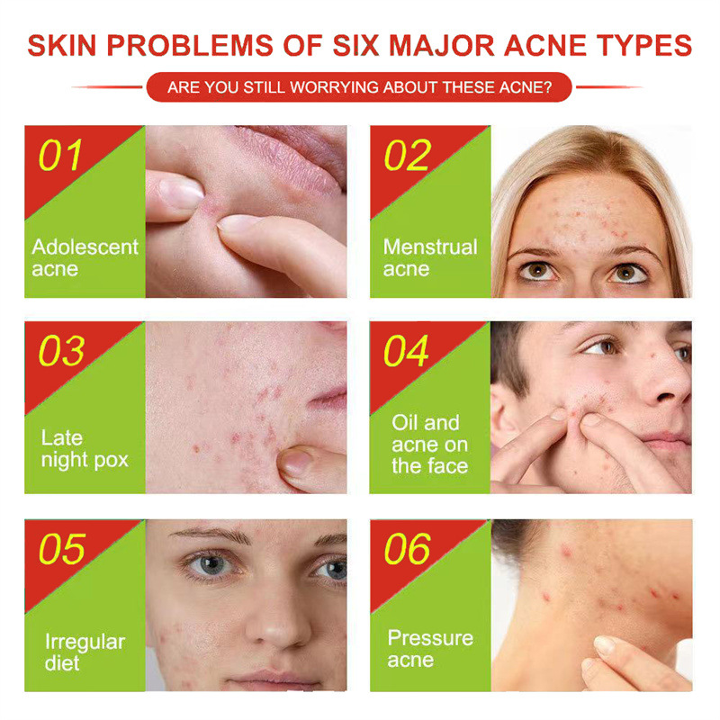 Patchs acne all'acido ialuronico a forma di cuore rosa_voghion.com