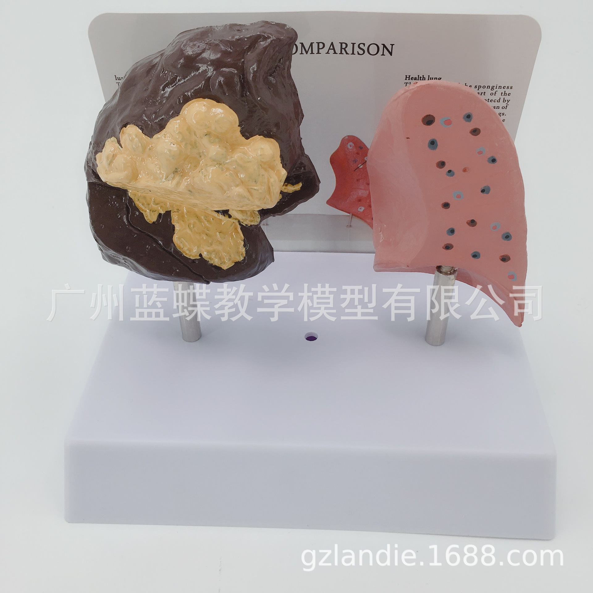 �������ཡ�����벡̬�αȽ�ģ�� �����ν���ģ�� �����ζԱ�ģ��