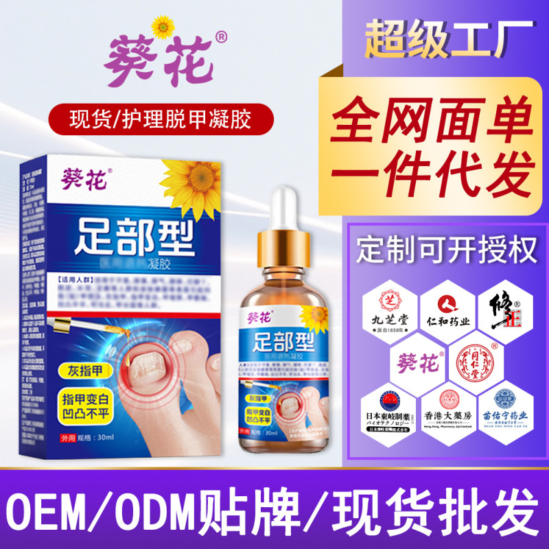 Sunflower Periungual Foot Onychomycosis Nail Removal Cream Household Herbal Foot Care Nail Care Nail Removal Gel Liquid
