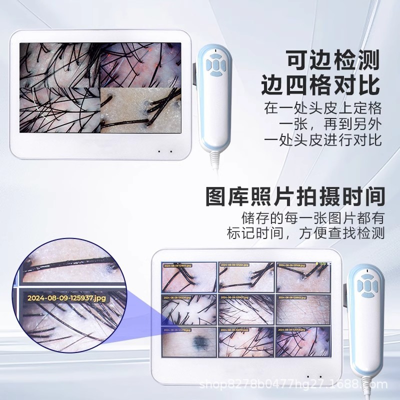 头皮检测仪毛囊高清头发测试仪器皮肤面部分析理发店带屏幕机|undefined