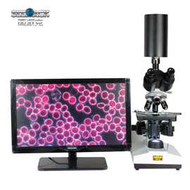 西派克黑背景一滴血检测仪黑背景 益生菌酵素菌专用生物显微镜