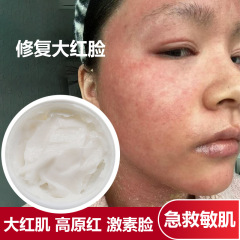美容院専用 角質層を厚くする 敏感肌修復 特殊ケアクリーム 赤み・炎症を抑える ホルモン性皮膚炎の鎮静・修復