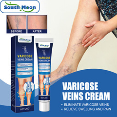 South Moon Varicose Vein Massage Cream Alleviates Swollen Leg Veins, Improves Varicose Veins, Repairs Spider Legs