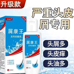 本物の康王ケトコンシャンプー、フケ防止、かゆみ止め、オイルコントロール、抜け毛防止、ダニ防止、抗菌液体シャンプー、保湿