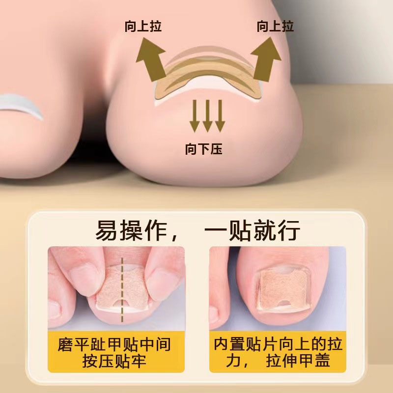 Adhesivos de uñas de ranura para uñas Adhesivos de uñas con incrustaciones de dedos de los pies