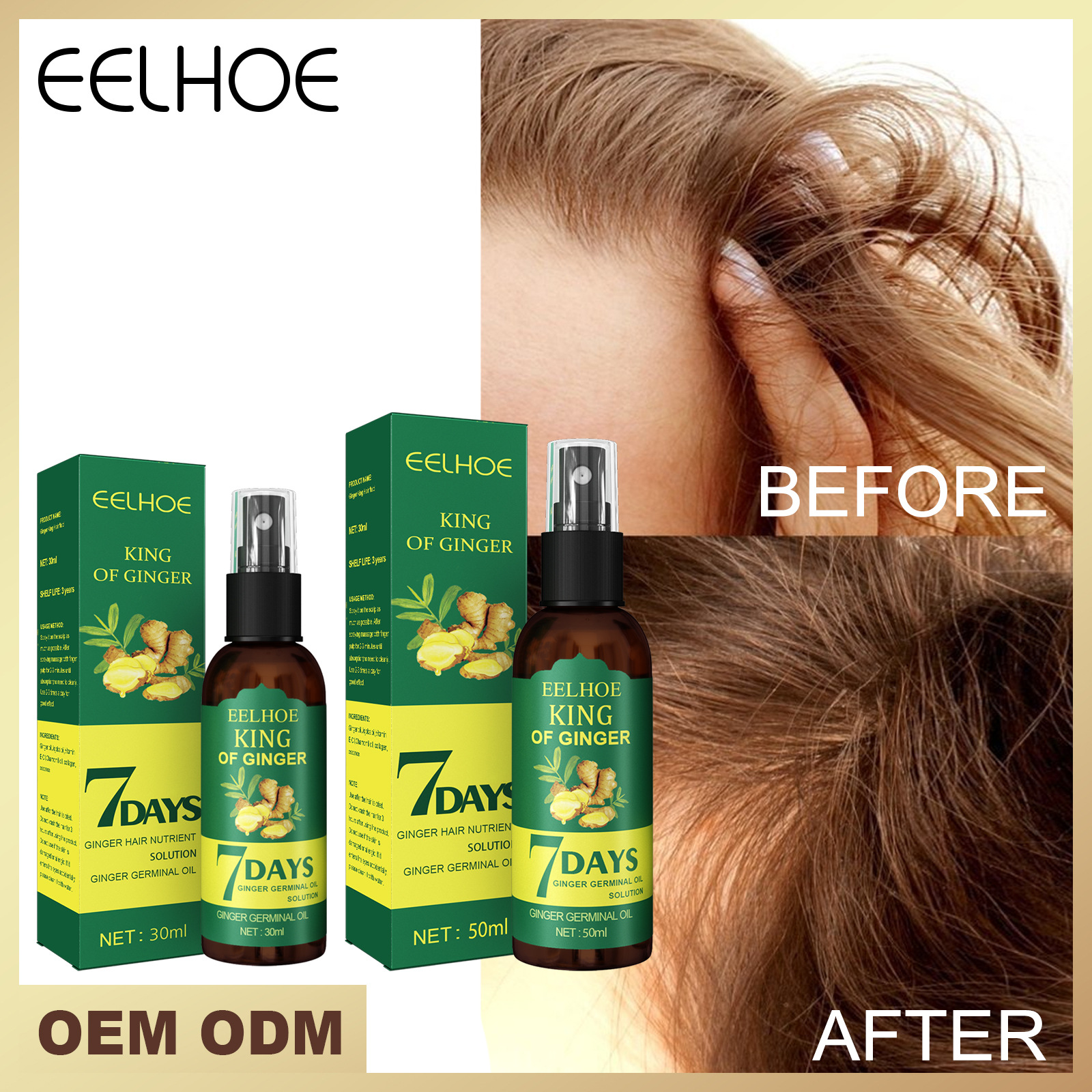 Spray Eelhoe para crecimiento de jengibre, masaje resistente, cuero cabelludo denso, reafirmante, prevención de pérdida de cabello, reparación, líquido nutritivo_voghion.com