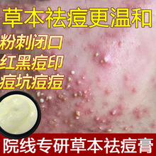 院线草本祛痘膏淡化痘印痘疤青春痘黑头粉刺改善闭口皮肤凹印痘坑