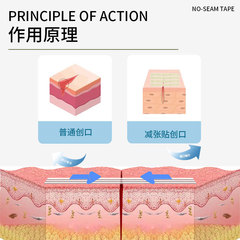 定製免縫膠帶減張貼醫用拉合膠帶膠帶膠布貼傷口閉合產後傷口敷料