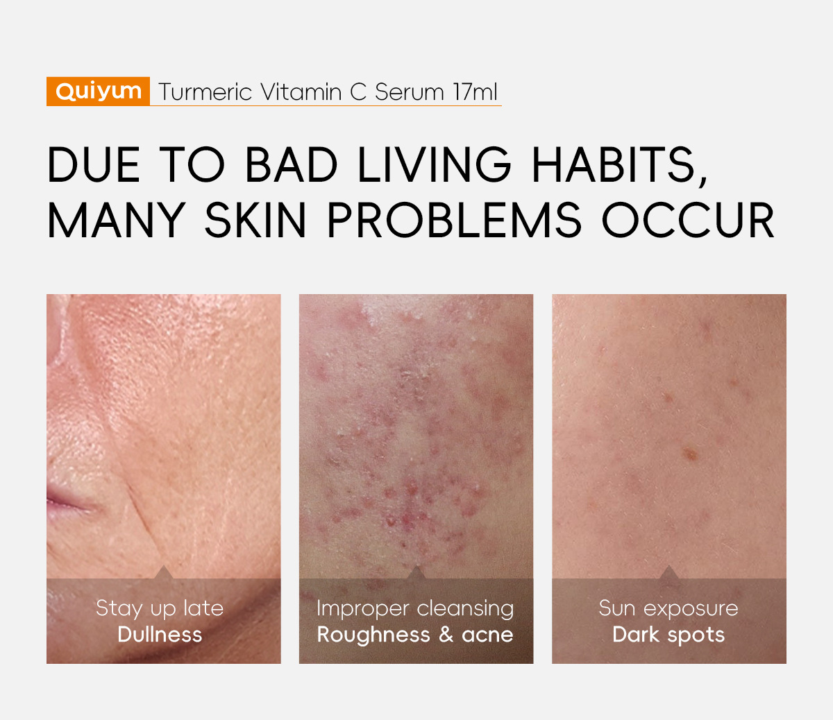quiyum cross-border new Product Turmeric Vitamin c Essence 17ml for hydrating, moisturizing and nourishing, in stock from the manufacturer undefined
