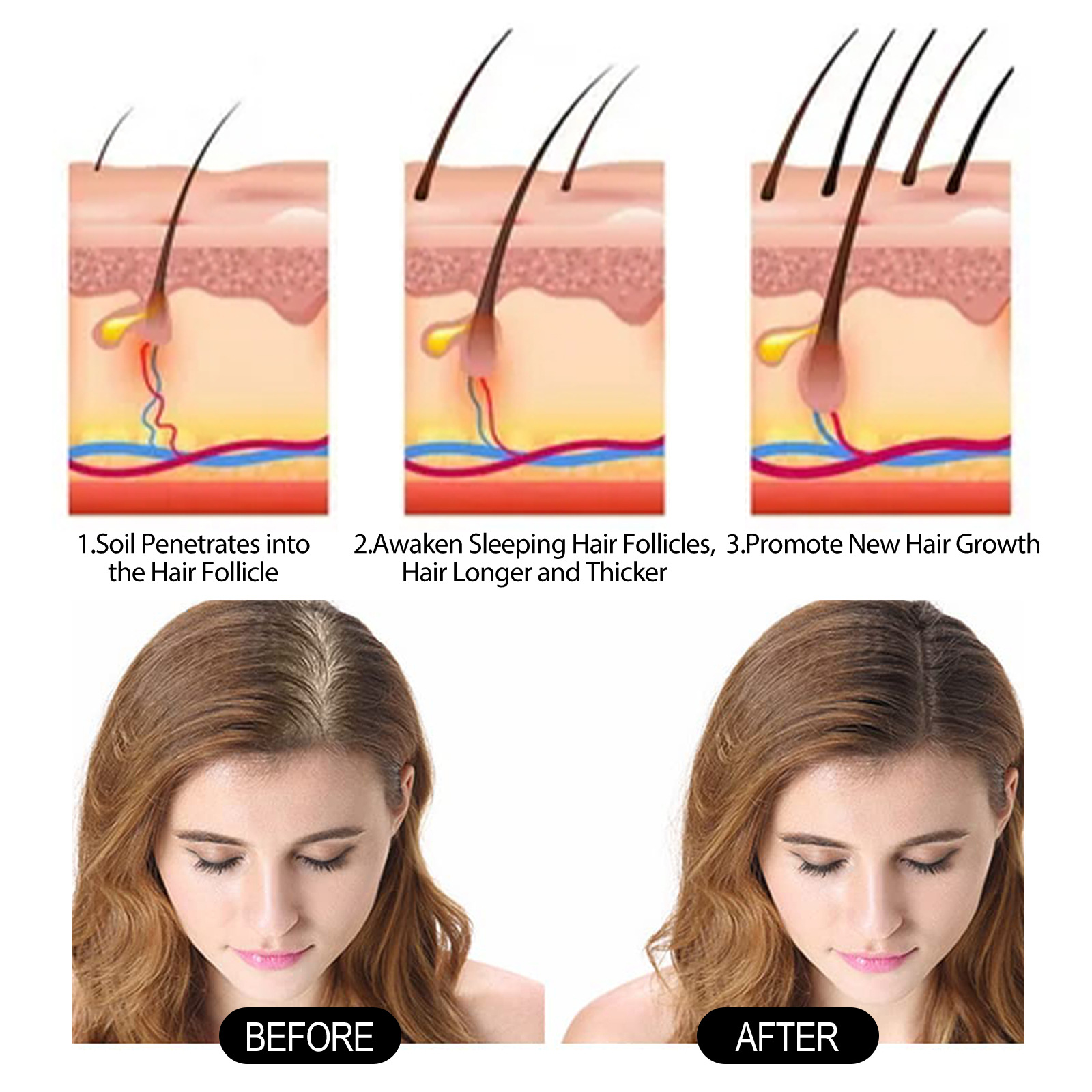 EELHOE Dense Oil Thickens Firms Hair, Nourishing Repairing Roots, Caring for Strong and Tough Hair_voghion.com