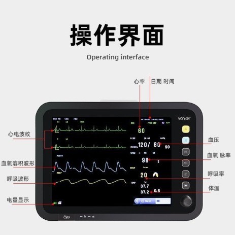 患者用マルチパラメータモニター、ポータブル多機能心電図心拍数パルスバイタルサインモニター、外国貿易モデル|undefined