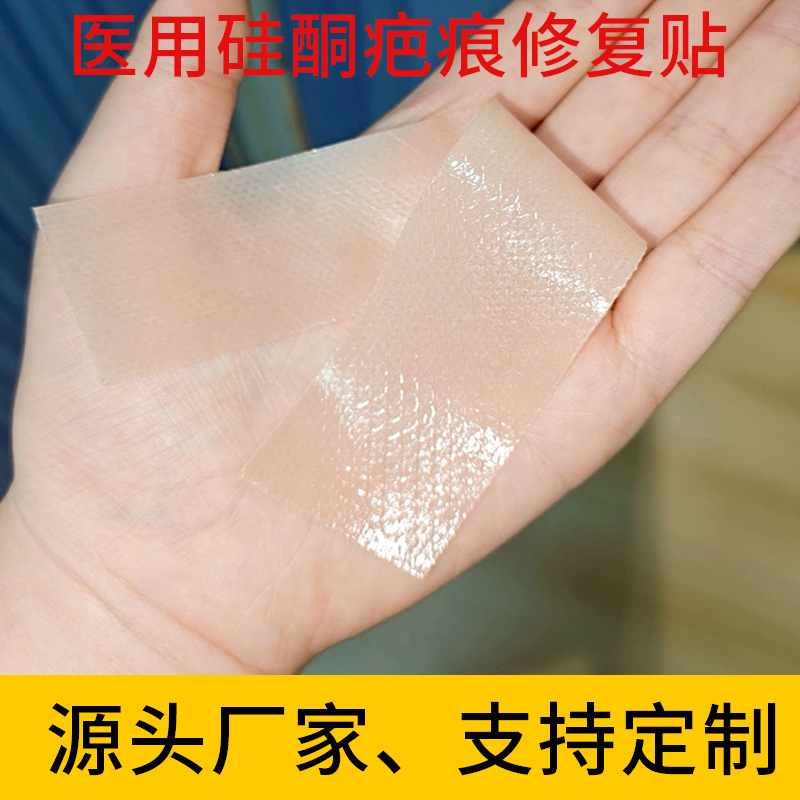 Oem Medical Scar Patch Custom Silicone Gel for Cesarean Section Surgery, Burns, Scalds, Trauma Scars, Skin-Colored Tape Roll