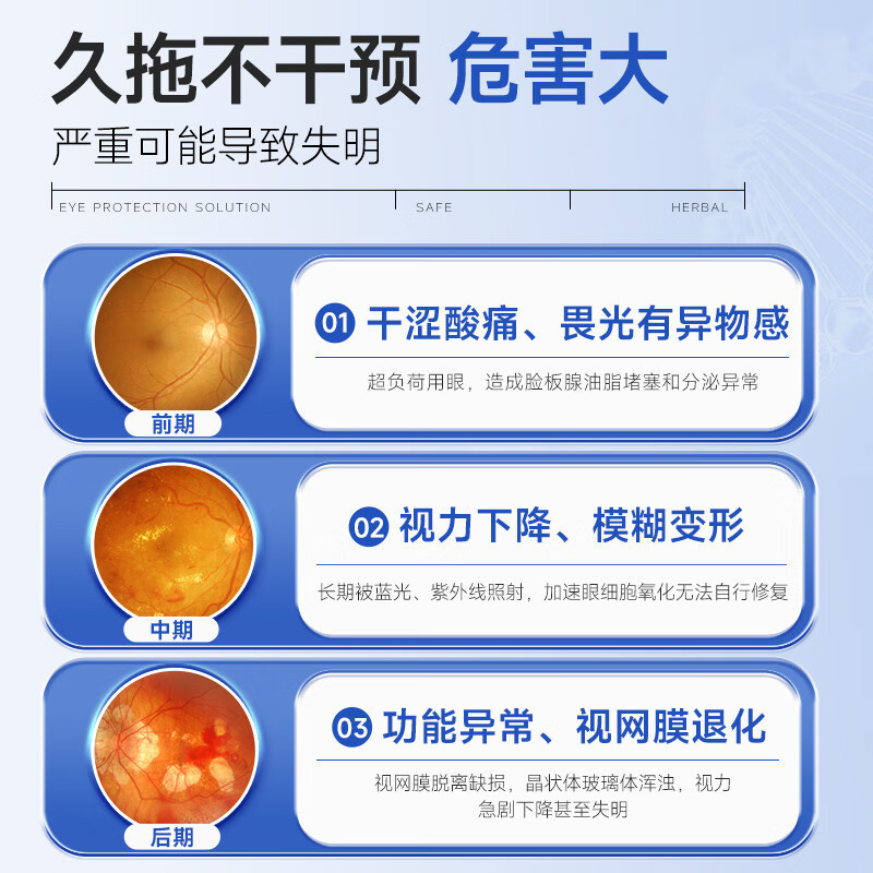 北京銅仁堂の目は風に流れて涙を流します、涙道が詰まり、目薬、高齢者の目は乾燥してかゆみを伴います|undefined