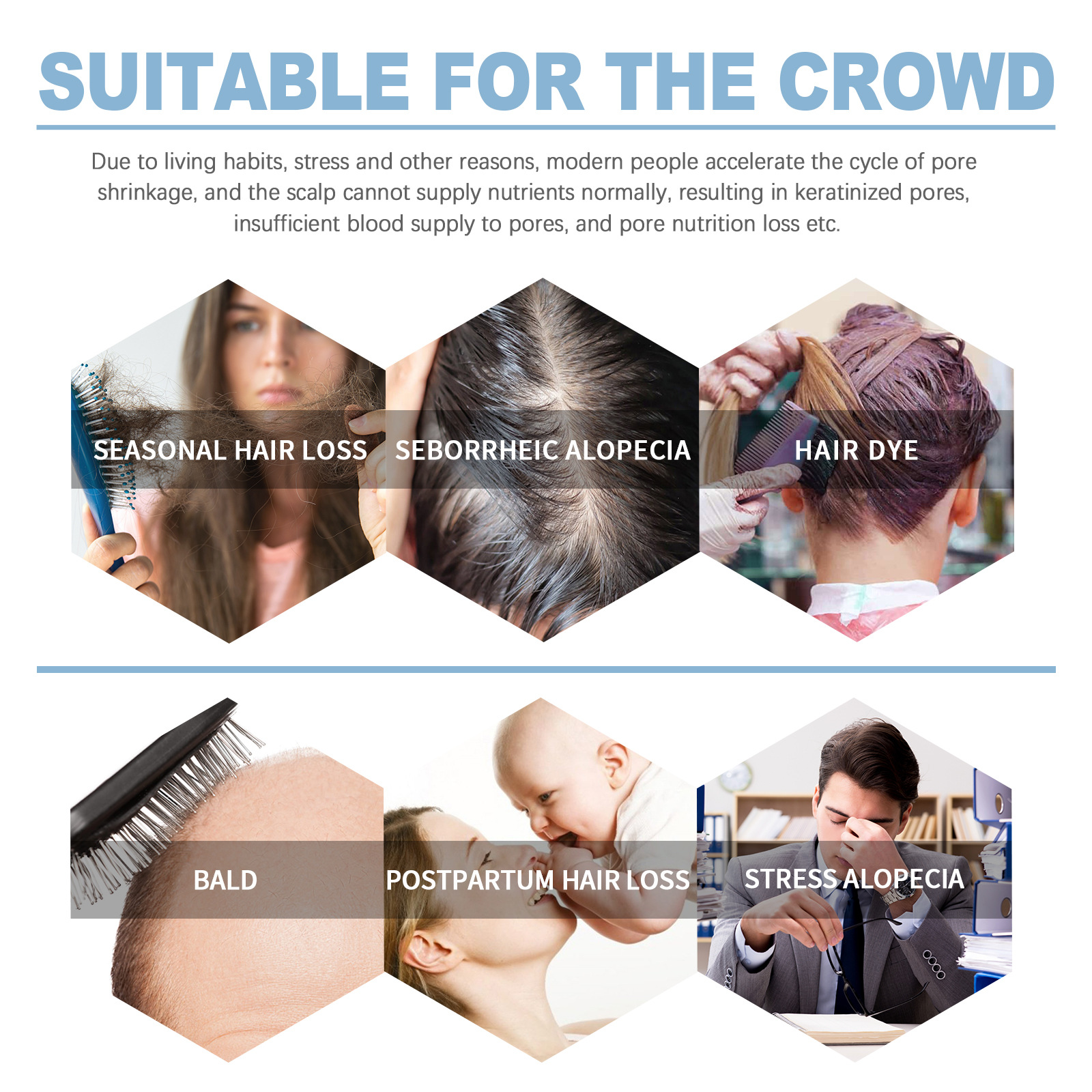 EELHOE Tykt Hår Skummende Shampoo Renser hovedbunden, fugter tykt hår, styrker håret, luftig og glat shampoo_voghion.com