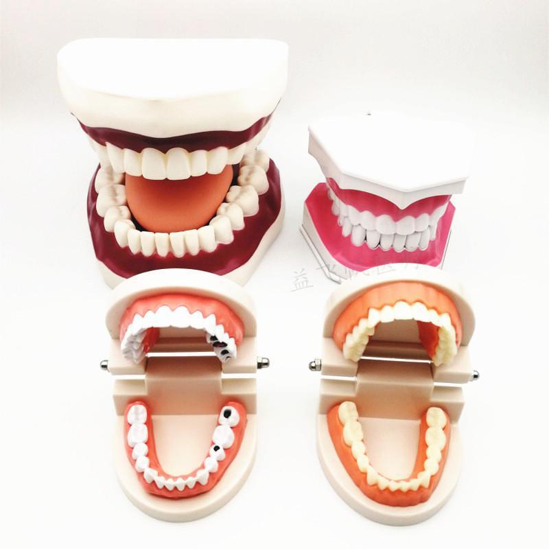 牙齿模型牙科教学假牙蛀牙幼儿园教学特大牙模型一件代发批发厂家