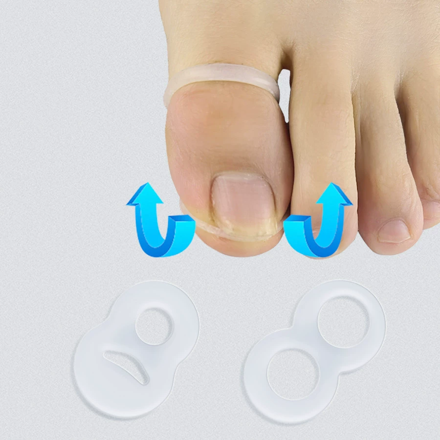 Инструмент для коррекции ногтей на ногах с силиконовыми накладками в форме цифры 8 для вросших ногтей, ногтей, выросших в стороны, и коррекции ногтей на ногах, комфортная коррекция.