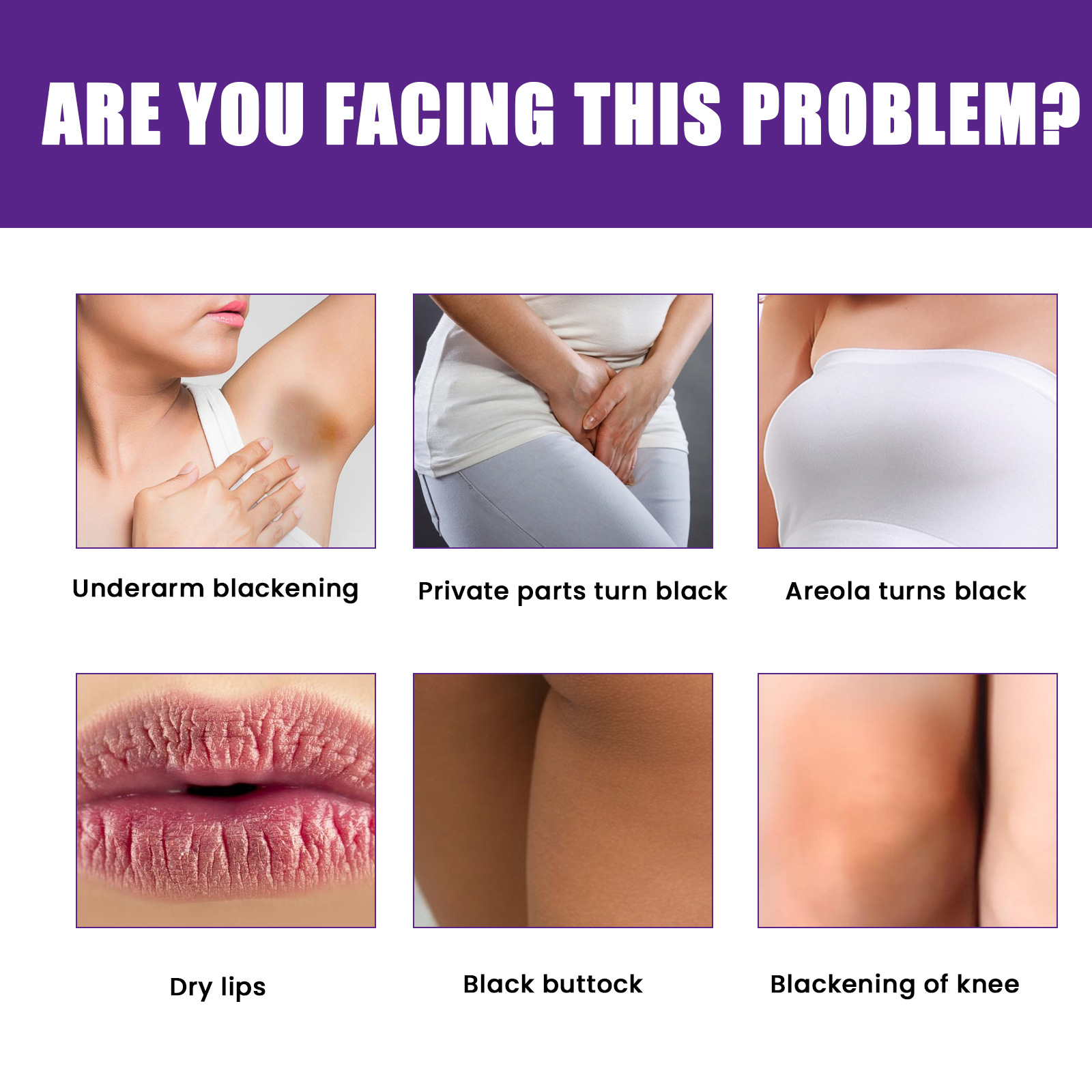 EELHOE Natural Brightening Moisturizing Cream Firms Skin, reduces melanin in the lips underarm joints, and_voghion.com