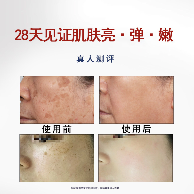 院线专供无尴尬期祛斑液排色液黄褐斑老年斑色素分解液美白蛋白液|undefined