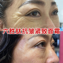 �����Ŀ�����˪ȥ����y̧�^�y�aˮ���������o��ȥ����������˪