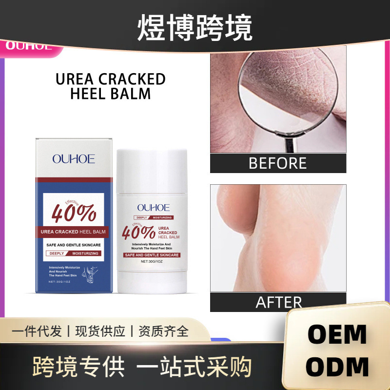 OUHOE Hand and Foot Moisturizing Stick Anti-freezing Cracking Moisturizing Skin Care Gel Suitable for Four Seasons Hand and Foot Cream Heel Cream OUHOE Hand and Foot Moisturizing Stick Anti-freezing Cracking Moisturizing Skin Care Gel Suitable for Four Seasons Hand and Foot Cream Heel Cream