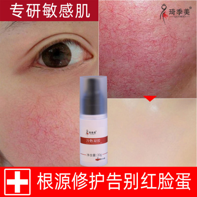 红血丝修护冷敷凝胶发烫泛红敏感肌肤皮肤红脸蛋去高原红告别红脸