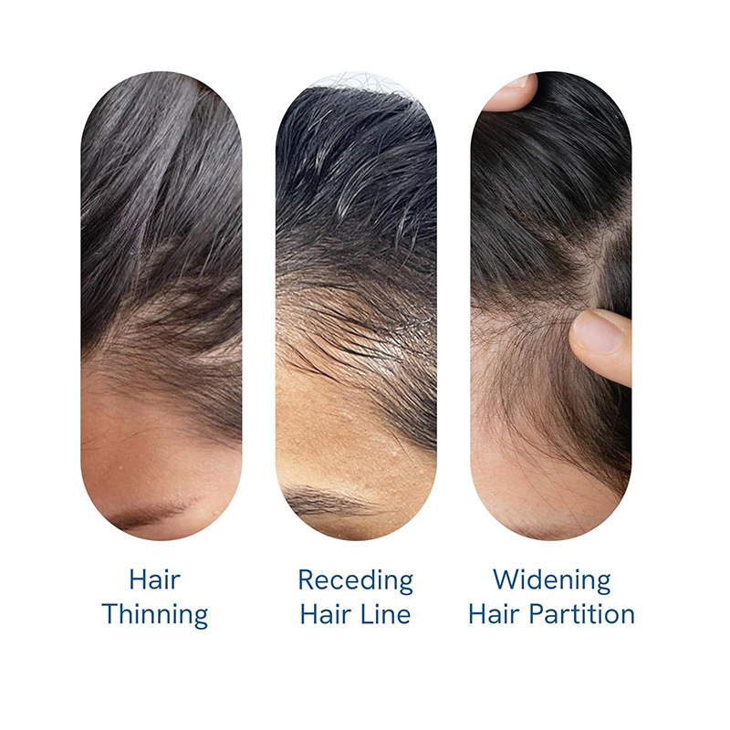 跨境外贸Rosemary Hair Growth Serum (Roll On)迷迭香护发精华液|undefined