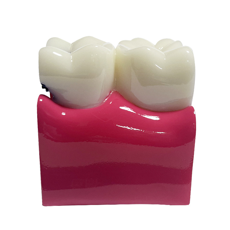 Equipo de enseñanza dental, modelo de comparación de caries 6x, modelo oral, modelo de enseñanza, modelo de dientes