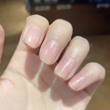 �۲������o���͠I�BҺָ�נI�B���ֲ��B�o��������Ƥ�̝�ָ������