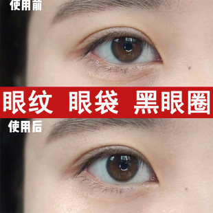 Collagen Eye Mask Removes Eye Bags, Removes Wrinkles and Dark Circles, Lifts, Tightens, Hydrates, Moisturizes, Anti-Wrinkles and Fades Fine Lines