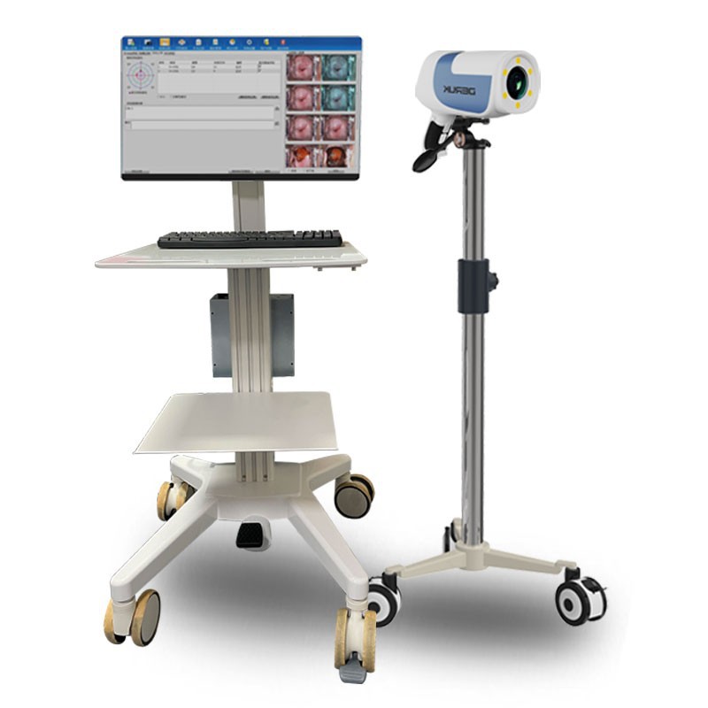 Colposcopio médico de alta definición endoscopio cervical vaginal colposcopio electrónico digital instrumento ginecológico de píxeles de alta definición