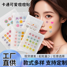 �羳��ɫ��ͨ���ﶻ���Nˮ�z�w��ēPE�����N