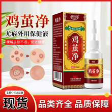 福美宜生鸡茧液20ml去脚趾疣瘊子足部手部根鸡尤平肉刺鸡眼液