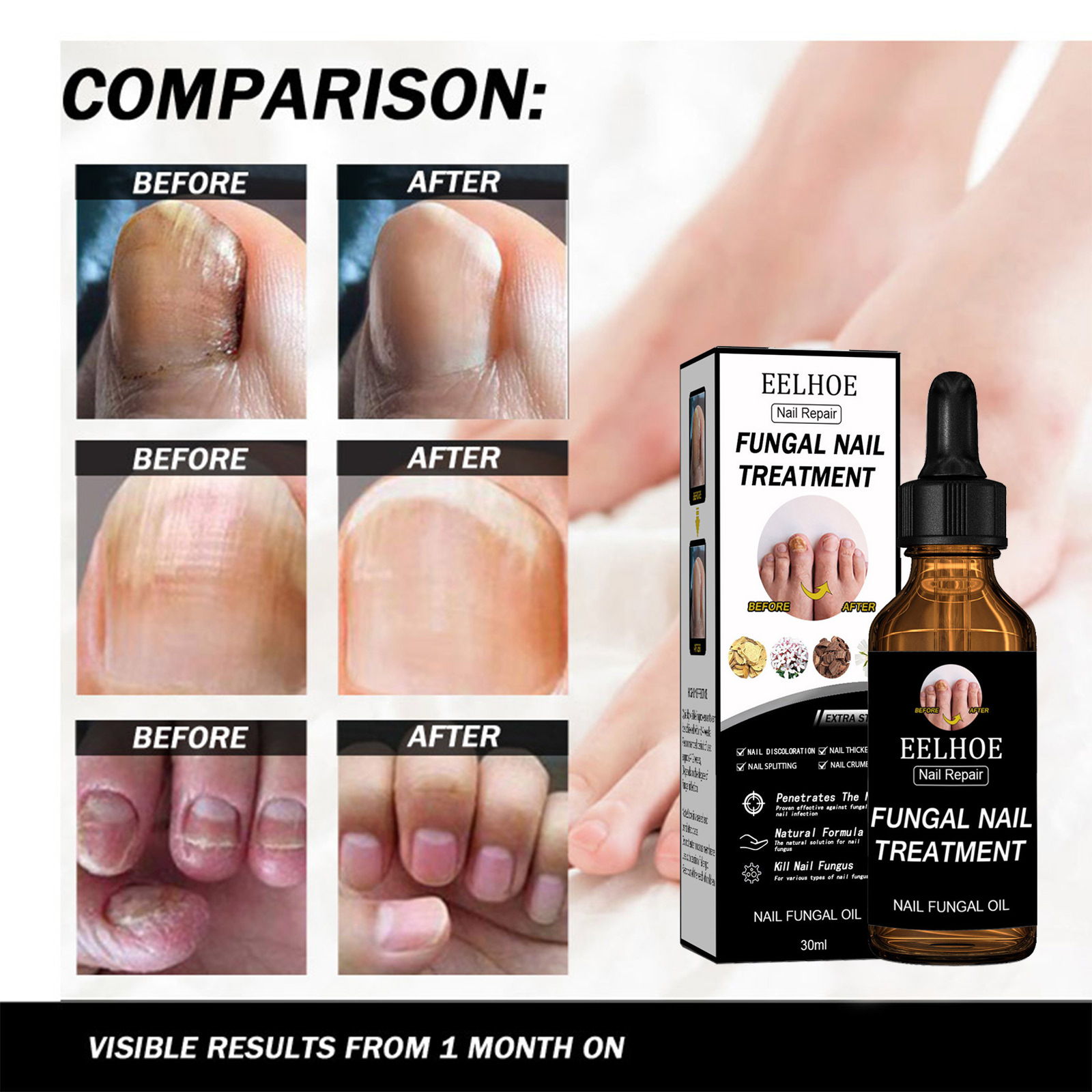 Die EELHOE Nagelreparaturlösung verdickt, hellt auf, entfernt Staub, Nägel und pflegt die Nägel_voghion.com