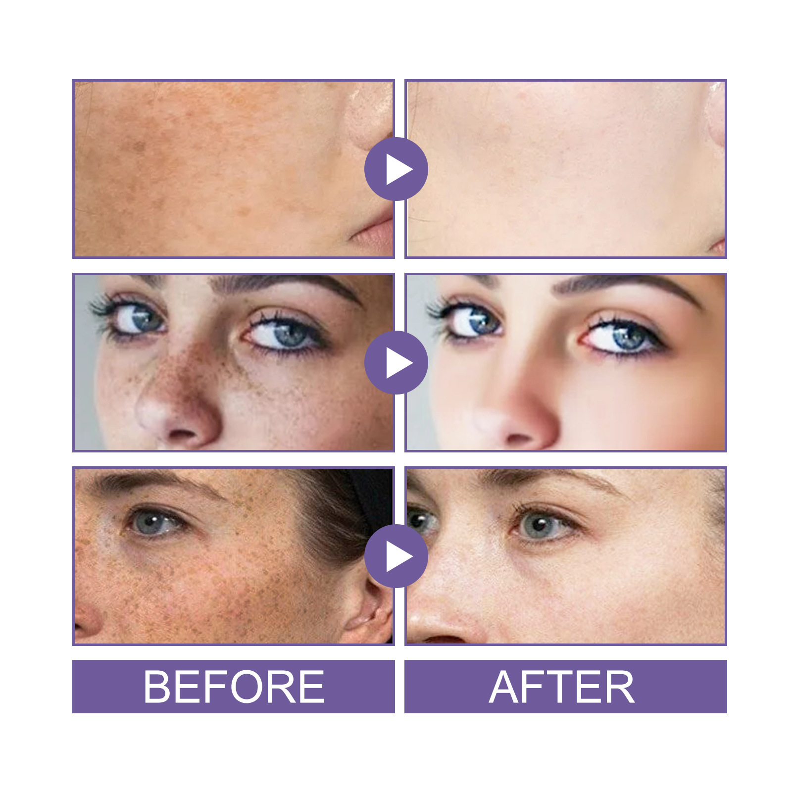 EELHOE Spot Repair Ball Lightens Blackspots, Yellowish Brown Spots, Melanin Moisturizes, Whitens, and Repairs Skin_voghion.com