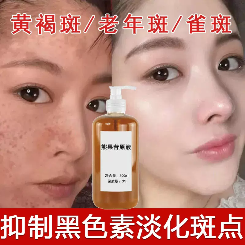 熊果苷原液淡化斑液排色液黄褐斑雀斑溶斑液精华液美容院正品批发