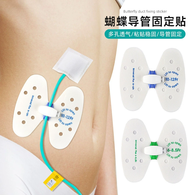 Регулируемое устройство для фиксации катетера для снижения нагрузки и давления, пластырь для фиксации катетера на поверхности кожи с пряжкой типа «бабочка».