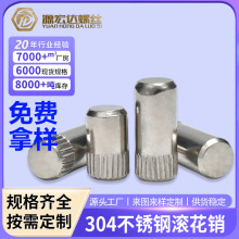 �S��ֱ�N304���P䓝L���NM1.5M8�껨�S���܇�S�A���Nᔶ�λ�N�S