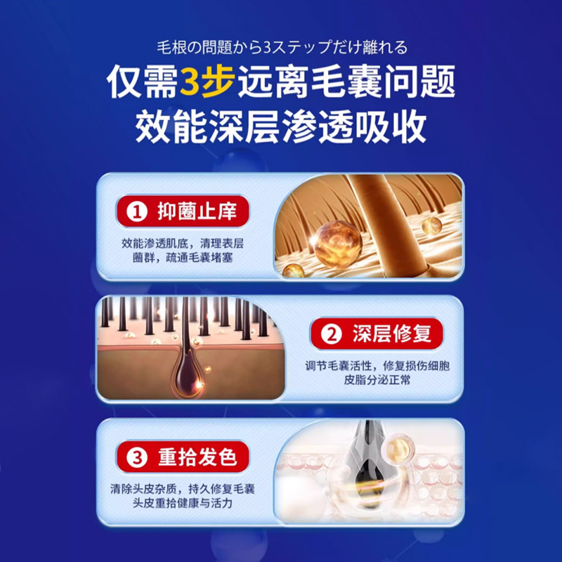 久研製薬頭部毛包治療炎シャンプー専用クリーム脂漏性治療皮膚炎頭皮屑工場直営|undefined